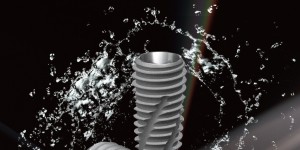 以国际标准铸品质，柯威尔亲水种植体筑牢口腔种植安全防线