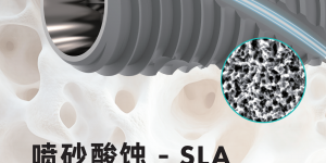 柯威尔亲水种植体：从表面处理到临床应用，重构种植效果新标杆