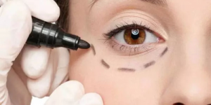 北京好年华：当“不开刀”成为一种潮流