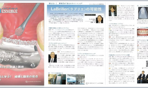 日本专家深度解读：LaBriller皓昕极薄贴面如何引领美齿新潮流，实现科技与美学的融合