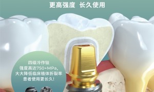 韩国中小企业研发卓越奖50强榜单公布！爱瑧IZEN（又名：爱臻）种植体荣登榜单，尽显创新实力