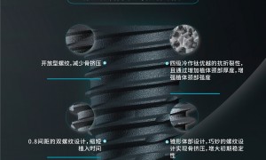 技术积淀与市场需求共振，韩国爱瑧IZEN（又名：爱臻）种植体口碑持续发酵