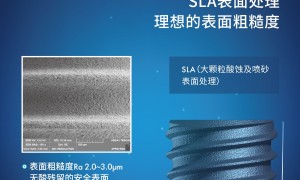 韩国爱瑧IZEN（又名：爱臻）种植体：深耕临床应用，赋能口腔医疗高质量发展