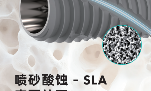 柯威尔亲水种植体：从表面处理到临床应用，重构种植效果新标杆