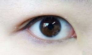 北京好年华于建华医生：内双到底算不算双眼皮？