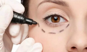 北京好年华：当“不开刀”成为一种潮流